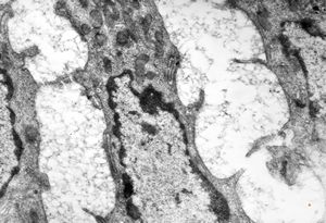 jejunum … lipid malabsorption jejunum … lipid malabsorption